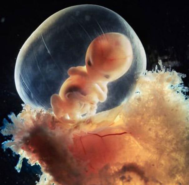 El Hermoso Milagro De La Concepción De La Vida