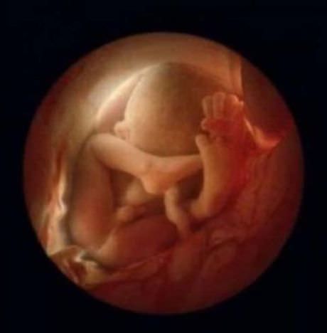 El Hermoso Milagro De La Concepción De La Vida