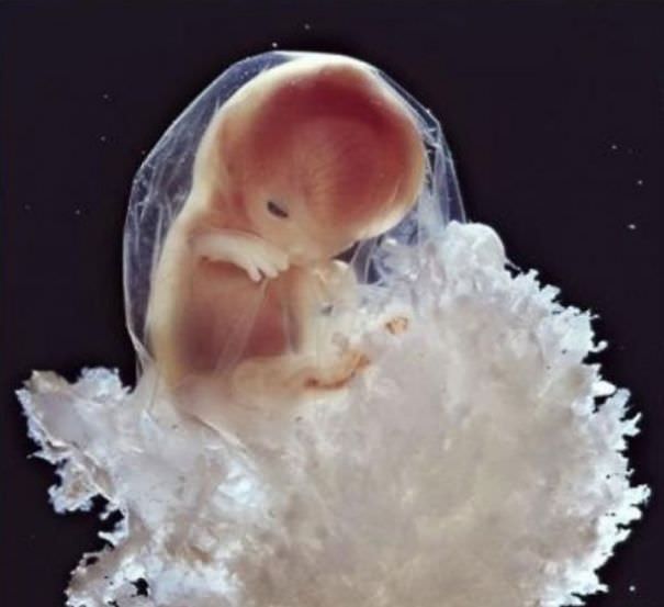 El Hermoso Milagro De La Concepción De La Vida