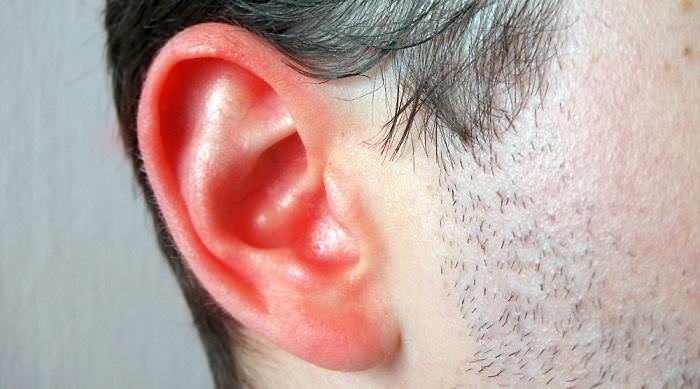 Remedios para el oído