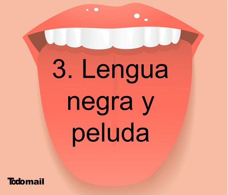 enfermedades lengua