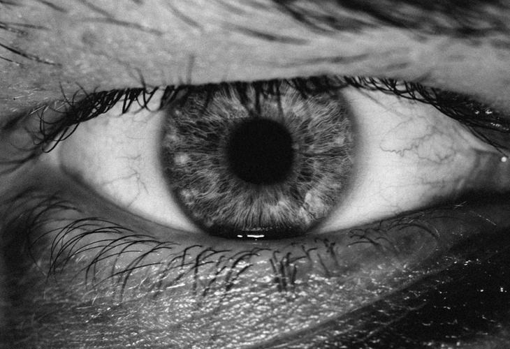 tensión ocular causas