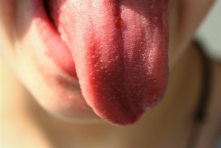 Primeros síntoimas cáncer lengua