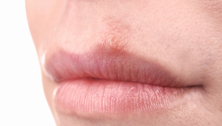 peligros de enjuague bucal mujer con labios secos