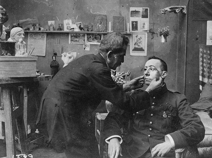 Implantación de máscara a soldado desfigurado segunda guerra