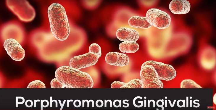 Bacteria asociada con Alzheimer Porphyromonas gingivalis 