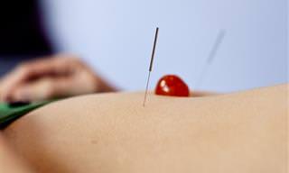 7 post sobre acupuntura 