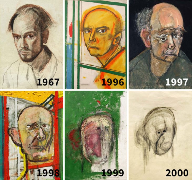    15. Un artista, William Utermohlen, después de ser diagnosticado con la enfermedad de Alzheimer, dibujó autorretratos de memoria hasta que ya no pudo reconocer su propio rostro.