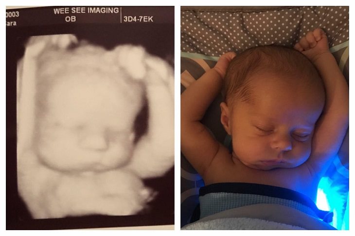 14. Una ecografía de 3 semanas antes de nacer y una fotografía tomada 3 semanas después