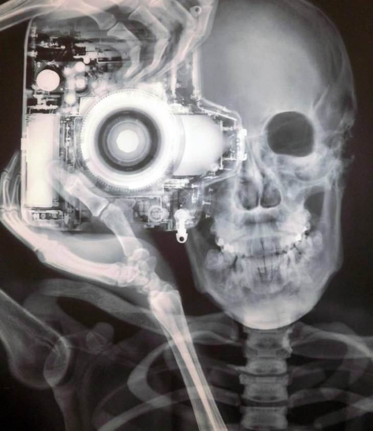 Imágenes De Curiosidades Del Mundo Selfie de rayos X