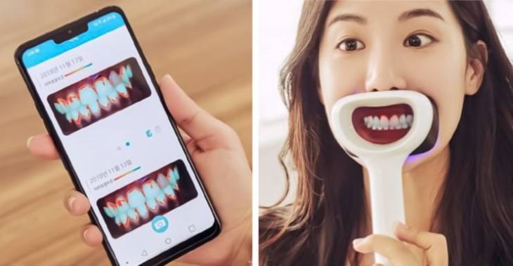 10. Este dispositivo de aspecto extraño está diseñado para limpiar los dientes sin un cepillo.