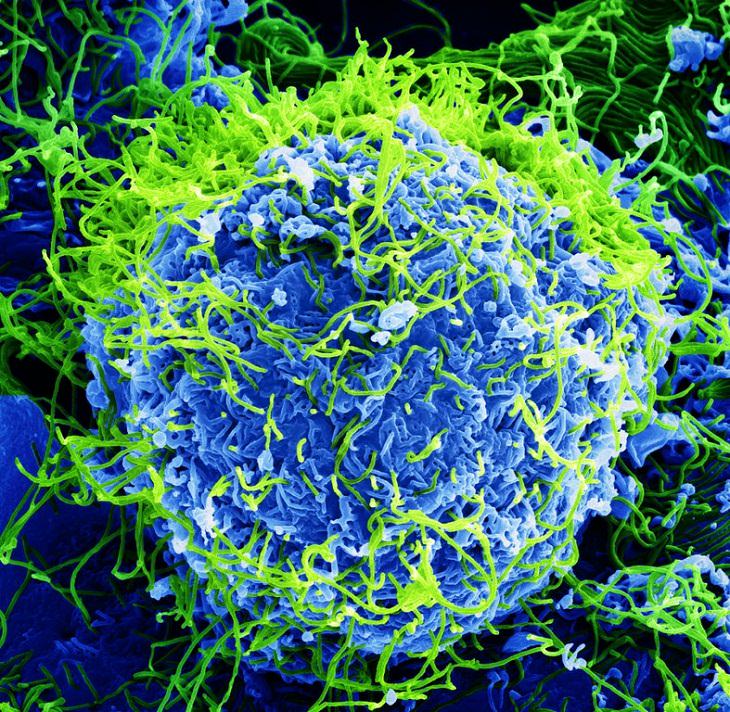 6 epidemias mortales before covid-19 ébola