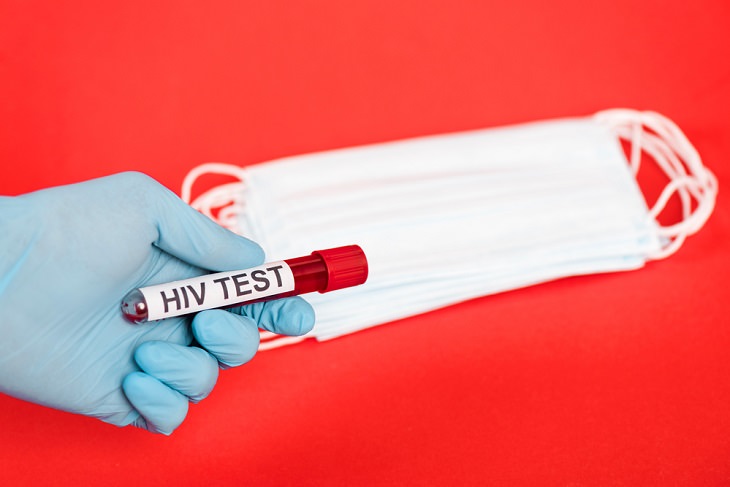 6 epidemias mortales before covid-19 . VIH / SIDA