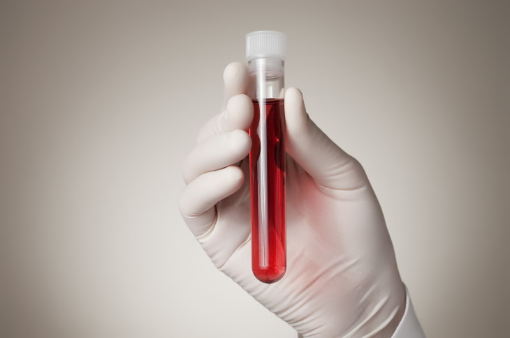 ¿Cómo funciona esta prueba? analisis sangre detectar cáncer