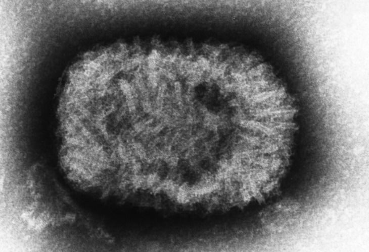 Los virus más peligrosos Viruela