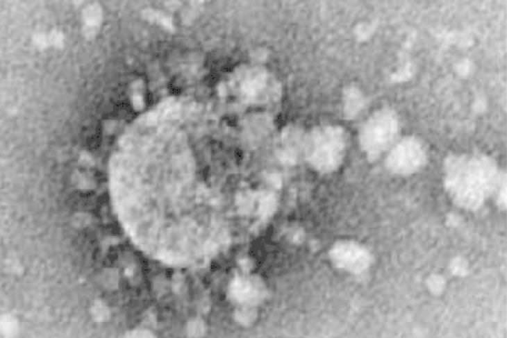 Los virus más peligrosos SARS-CoV