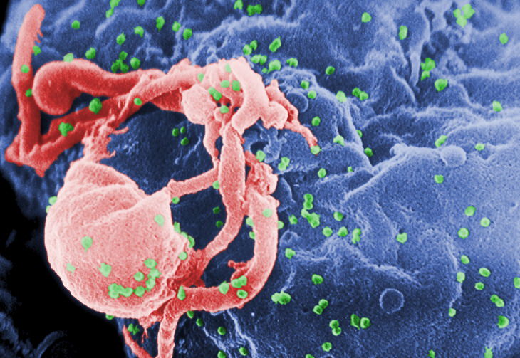 Los virus más peligrosos Virus de inmunodeficiencia humana (VIH)