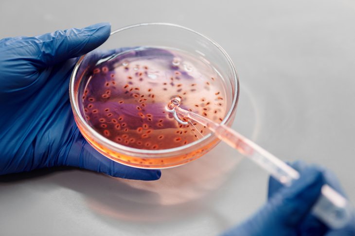 Consenso Científico gérmenes en placa de Petri