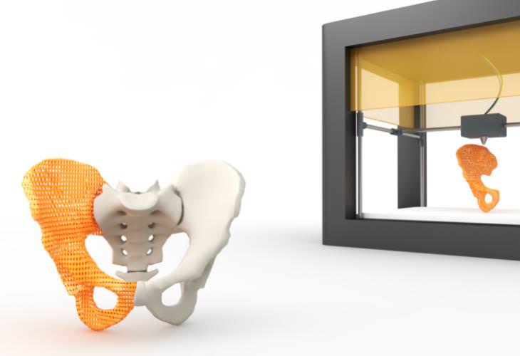 Cosas que esperar en 2022, implantes óseos impresos en 3D