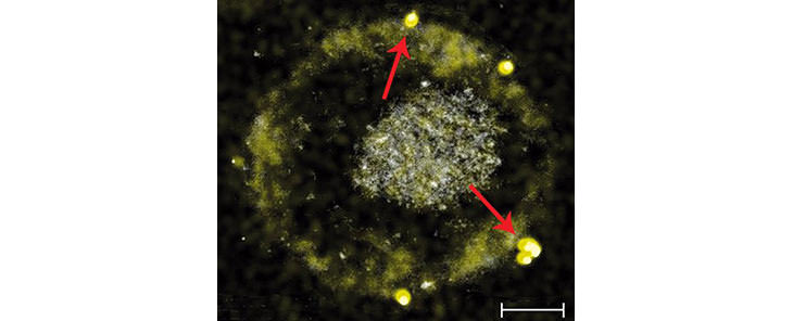 Bacteria Que Convierte Los Metales Tóxicos En Oro Cupriavidus metalidurans proceso