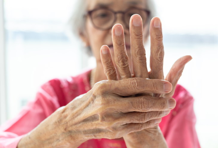 4. Ayuda a reducir los síntomas de la artritis