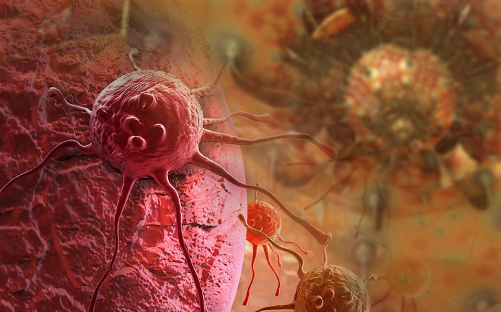 Un Nuevo Tratamiento Destruye Los Tumores En Tres Tipos De Cáncer