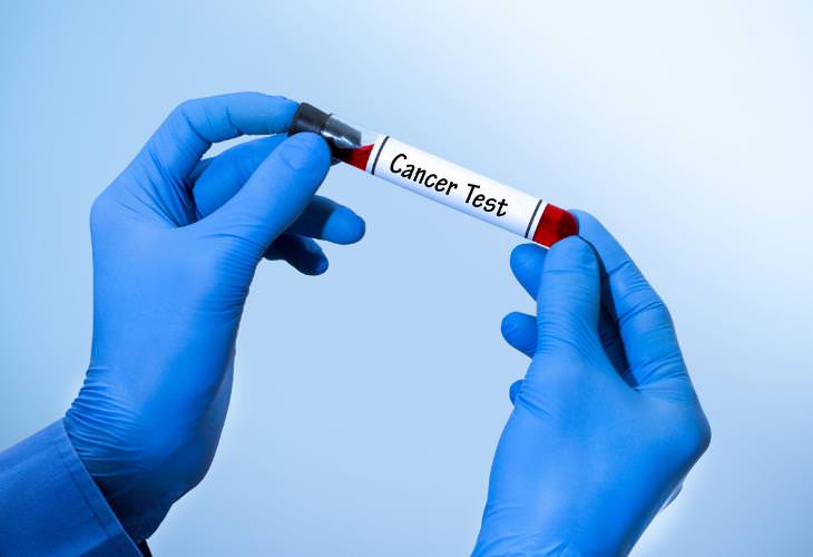 Avances Médicos Del 2021, análisis de sangre para detectar el cáncer temprano