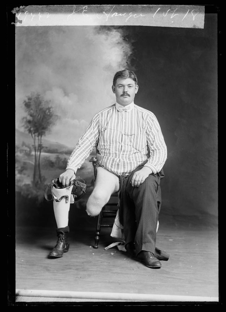 Retratos Del Siglo XIX, Un hombre con una pierna amputada sosteniendo su prótesis