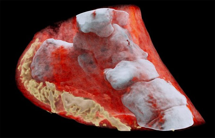 Radiografías a color, radiografía 3D a color huesos