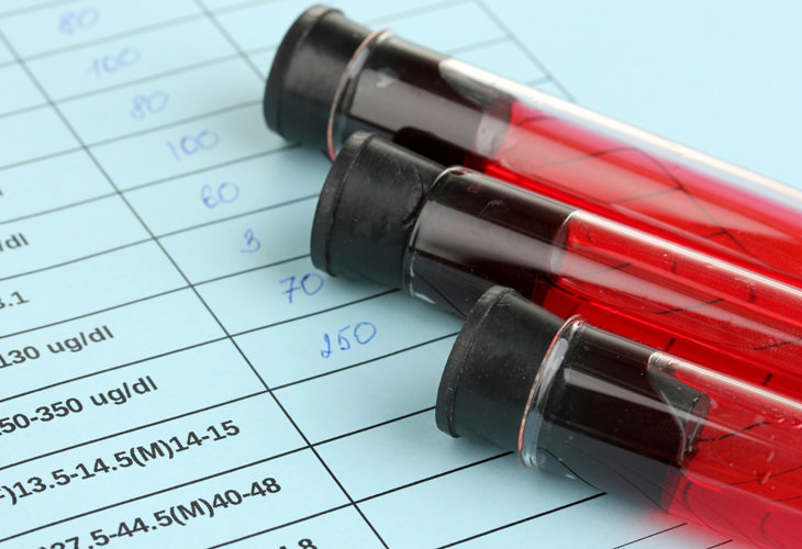 Investigación Cura Para El VIH, muestra de sangre