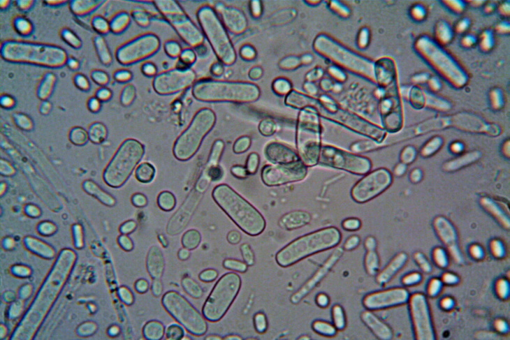 Bacterias intestinales y artritis reumatoidea Bacterias bajo el microscopio