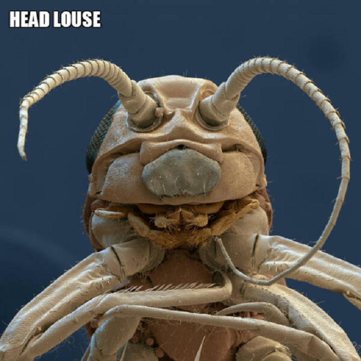 Close-Ups of Bugs & Creatures, Head louse