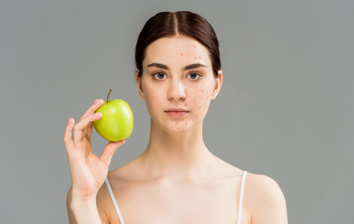 Beneficios De Las Manzas Para La Piel, mujer sosteniéndo una manzana