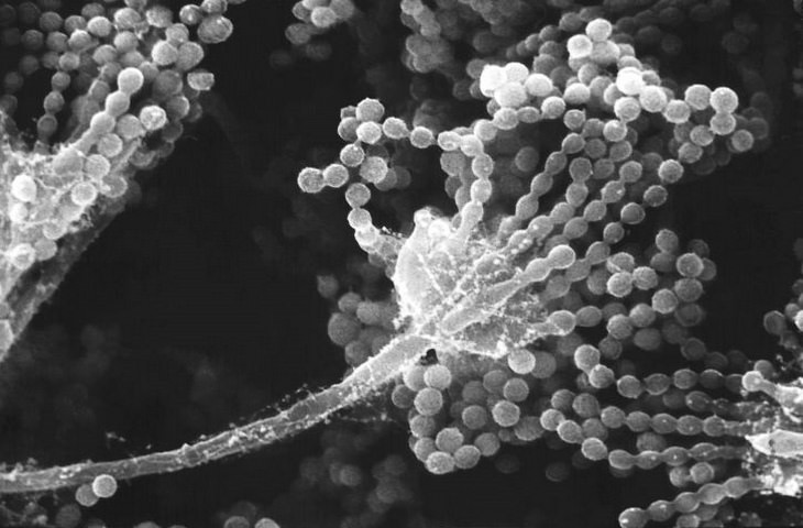 Hongo Elimina Desechos Plásticos, moho en el microscopio