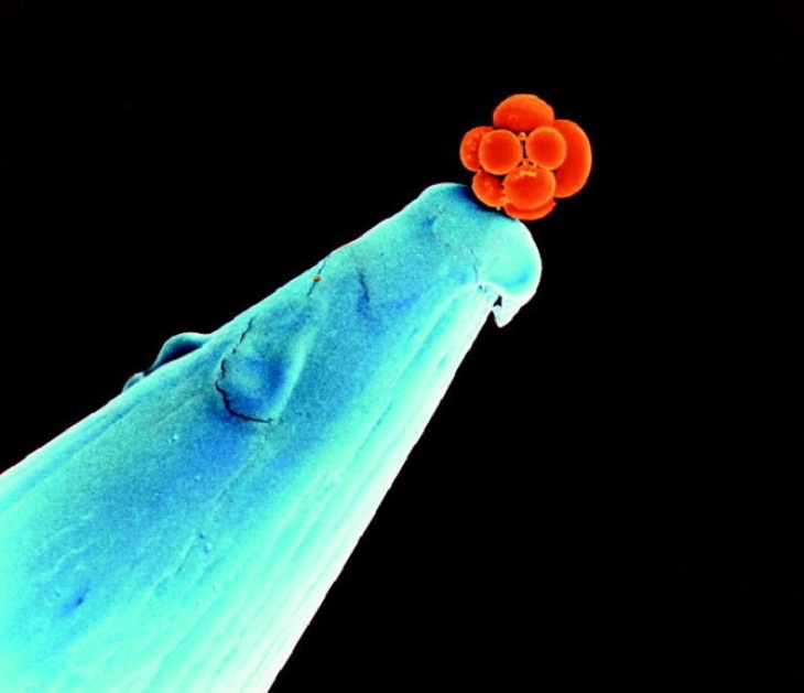 Embrión humano en etapa temprana