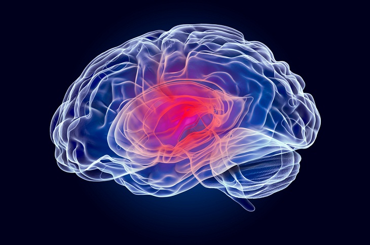 Dispositivo Contra El Cáncer Cerebral, tumor cerebral
