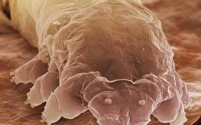 ácaro de las pestañas bajo el microscopio