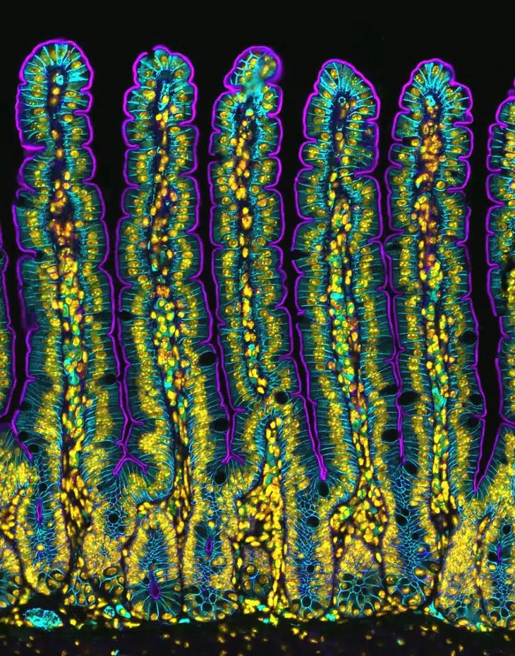 Concurso de fotomicrografía del Mundo Pequeño de Nikon 2024