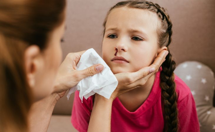 Causas y Tratamiento Del Sangrado Nasal