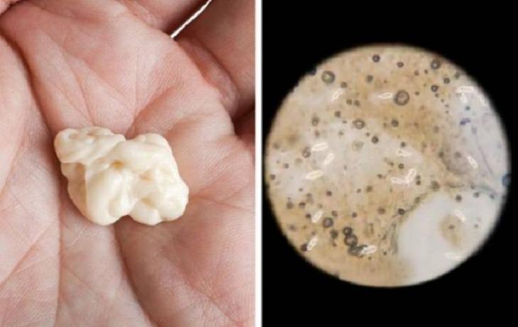 Objetos Vistos Desde El Microscopio