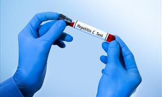 Estos Síntomas Podrían Alertar Sobre La Presencia De Hepatitis C