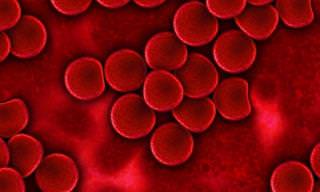 Anemia: Causas, Síntomas y Tratamientos
