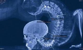 Estas 13 Radiografías Son Geniales y a La Vez Extrañas
