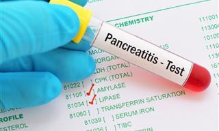 Conserva La Salud De Tu Pancreas Con Estas Recomendaciones