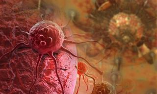 Un Nuevo Tratamiento Destruye Los Tumores En Tres Tipos De Cáncer