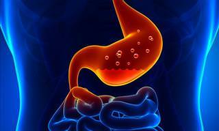 Salud: 6 Indicios De Problemas Gastrointestinales