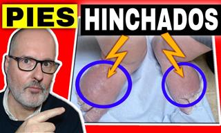 Principales Causas y Tratamientos Para Las Piernas Hinchadas