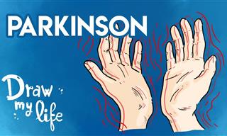 Los Síntomas y Causas De La Enfermedad De Parkinson