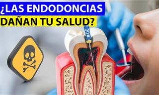 ¿Sabes Sobre La Endodoncia o Tratamiento De Conductos?