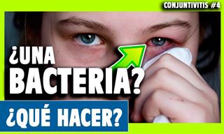 Estas Son Las Principales Señales De Una Conjuntivitis Bacteriana